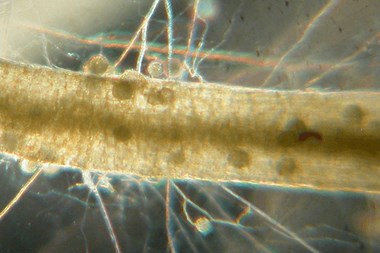 Vista microscopica de una raiz de micorrizas