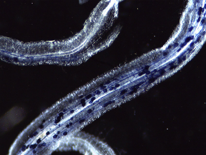 Stained plant roots as seen under a microscope