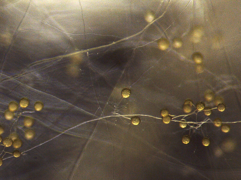 Vue des spores mycorhiziennes au microscopes