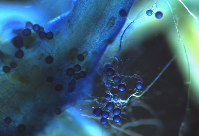 Intra and extra root spores colored with Cotton Blue